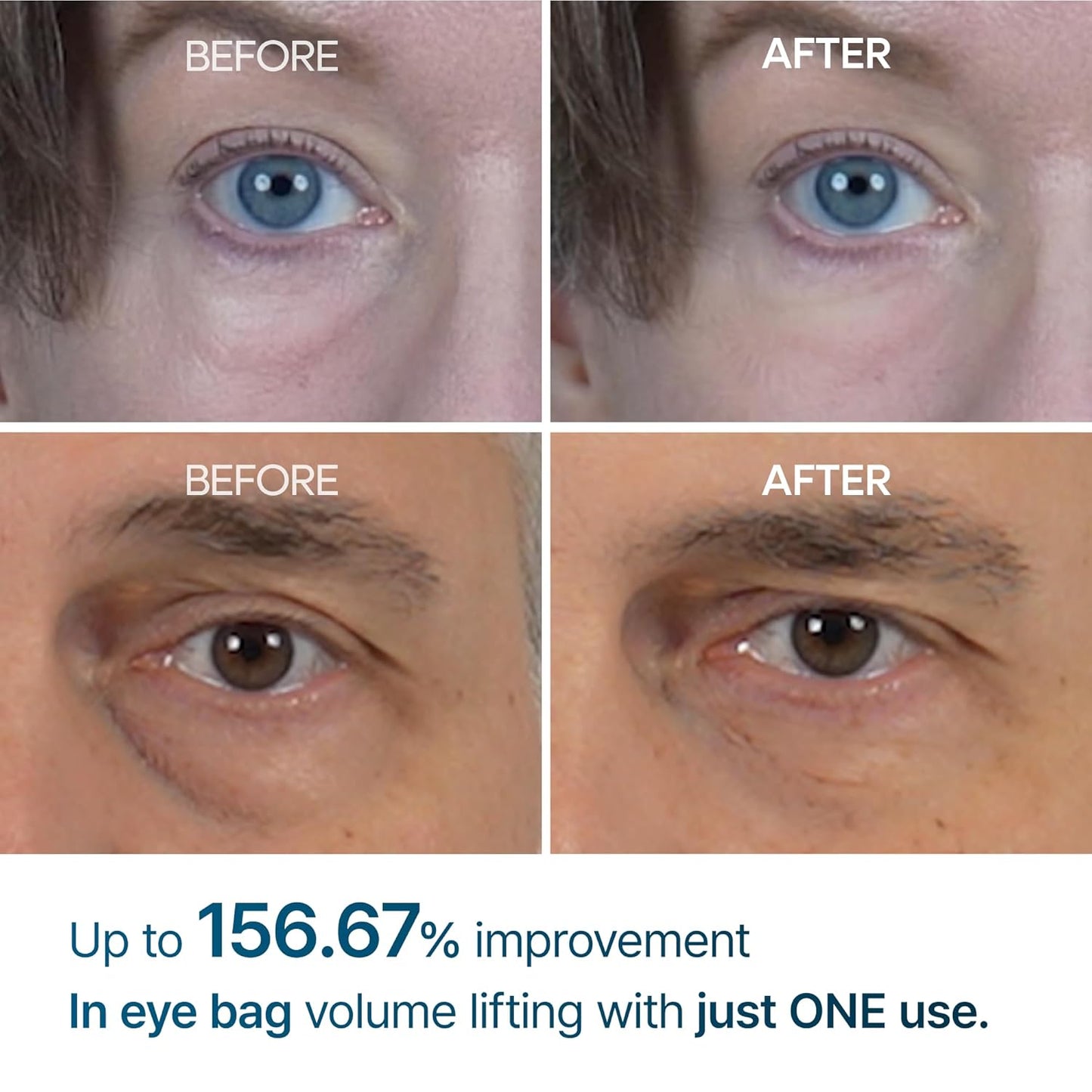 Dr. Melaxin EYEPHALT Eyebag Cream