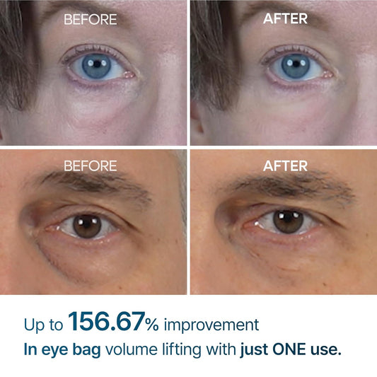 Dr. Melaxin EYEPHALT Eyebag Cream
