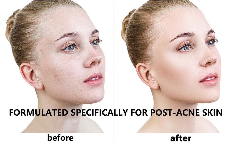 345 Relief Cream